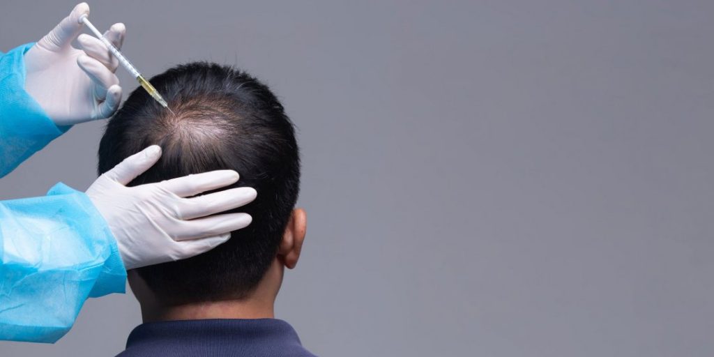 A Detailed Guide on the PRP Hair Restoration Technique: Are you the Right Candidate?