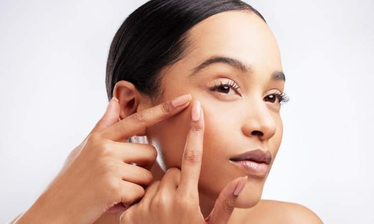How Pimple Patches Complement Modern Beauty Wardrobes