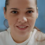 How Skin Whitening Treatments Address Melasma and Freckles