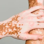 Common Conditions That Can Be Improved with Paramedical Tattooing