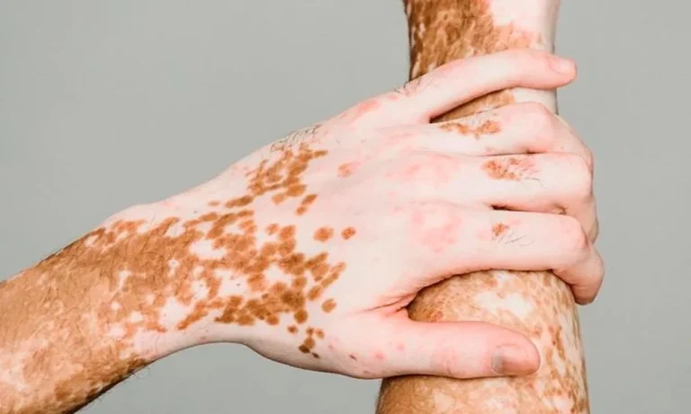 Common Conditions That Can Be Improved with Paramedical Tattooing
